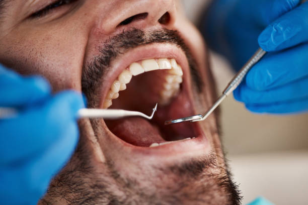 Best Emergency TMJ Treatment in Beggs, OK