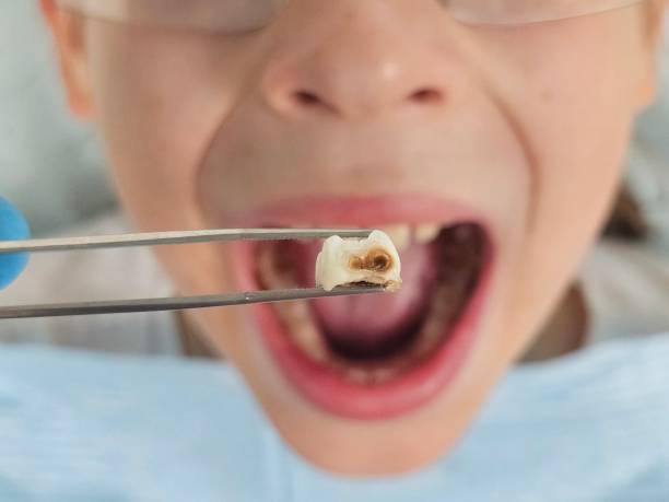Best Emergency Denture Repair in Beggs, OK