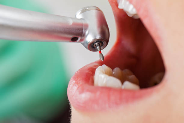 Best Weekend Emergency Dentist in Beggs, OK